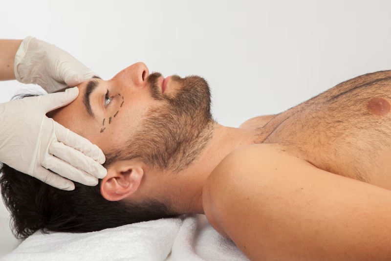 Male Surgery